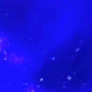 Meet your Posher, Anel